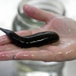 Продажа медицинских пиявок