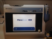 Аппарат Fibroscan402